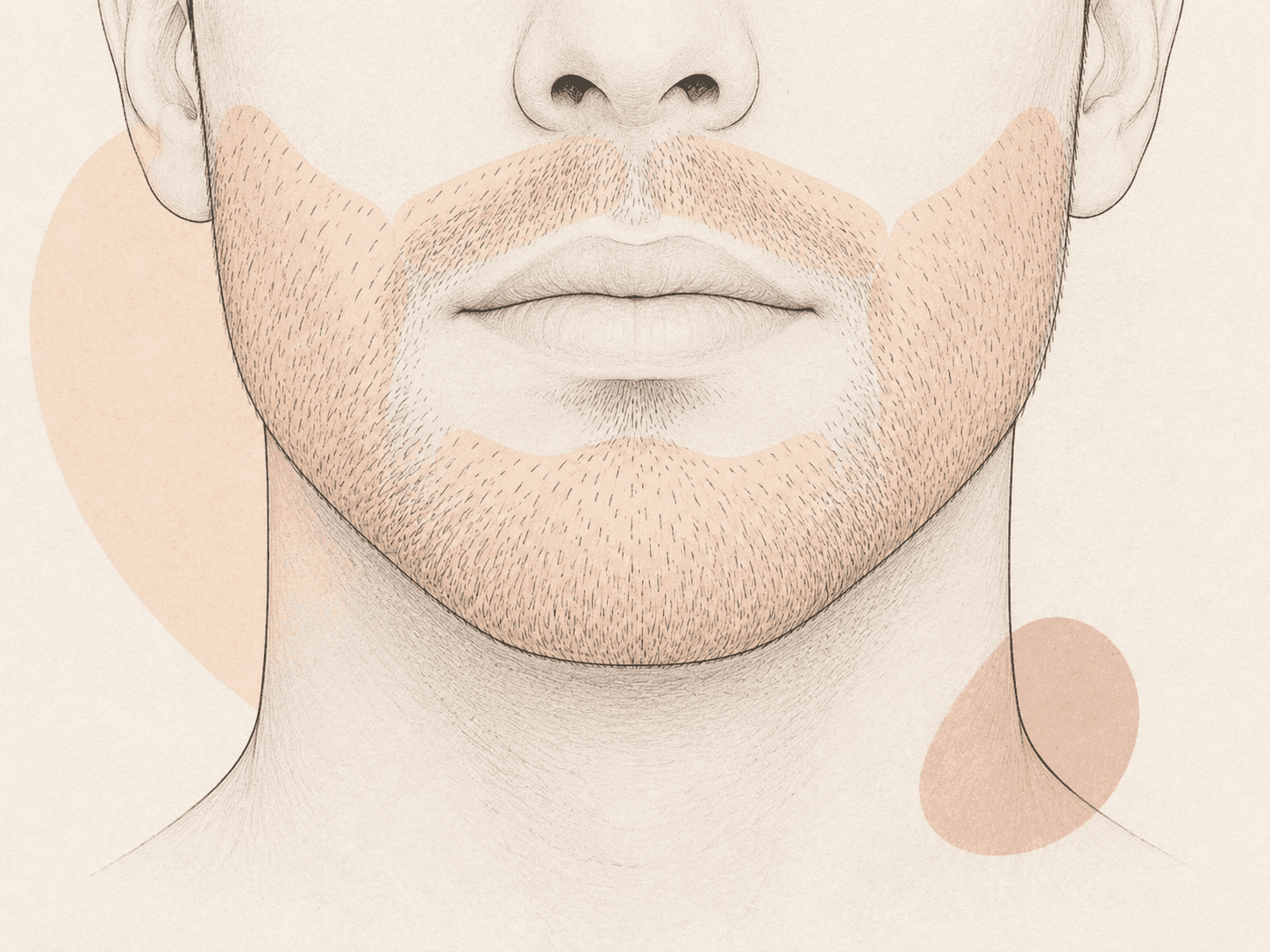 Beard Hair Transplantation