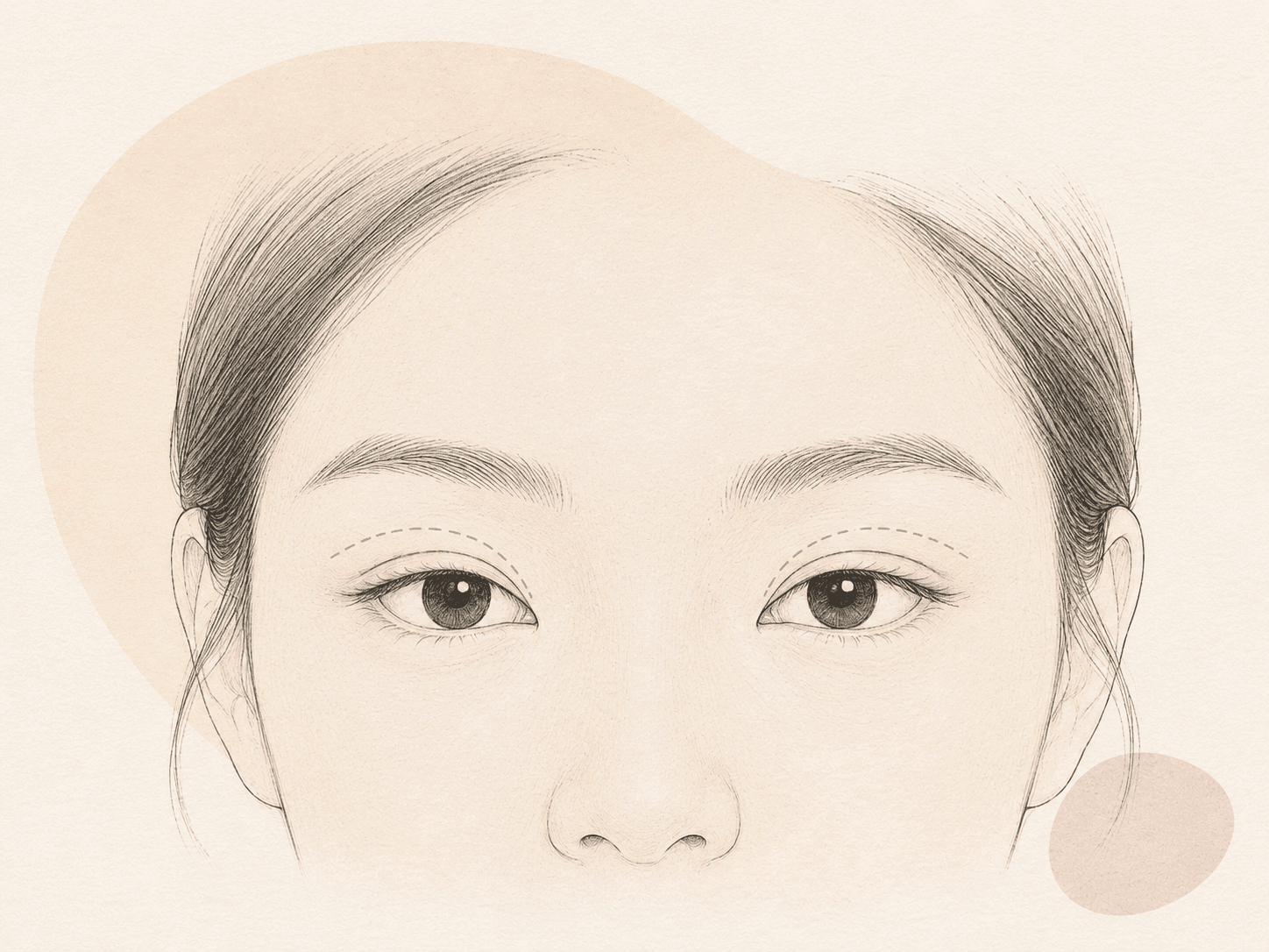 Double-Eyelid-Blepharoplastik