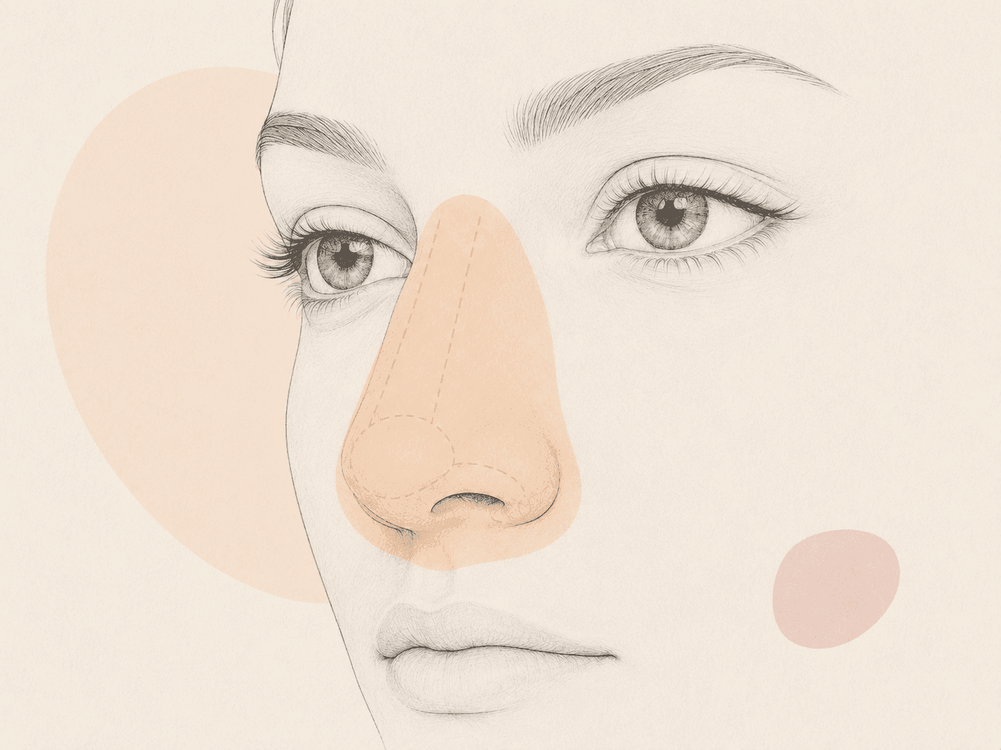 Rhinoplasty