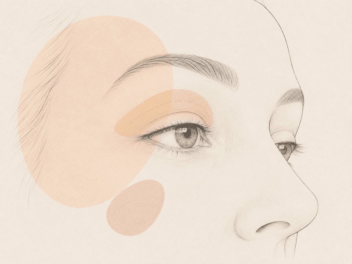 Upper Eyelid Blepharoplasty